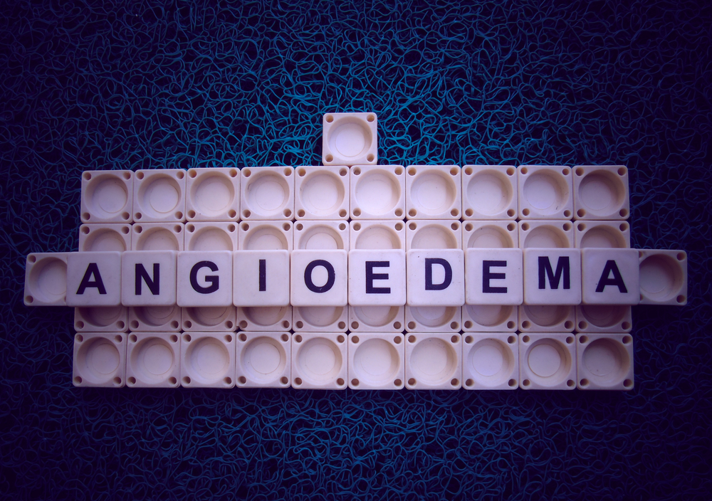 Obrázok písmen angiodema
